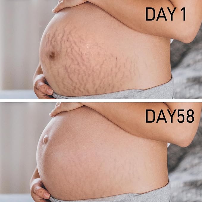 Stretch Mark Cream for Pregnancy & Postpartum,with Argan Oil, Shea Butter & Vitamin E,Stretch Mark Prevention for Belly,Moisturize Skin,Prevent & Fade stretch marks (100ml_1PACK)