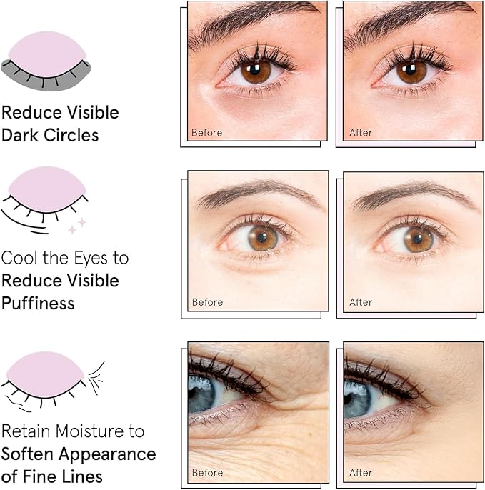 grace & stella Award Winning Under Eye Mask Reduce Dark Circles, Puffy Eyes, Undereye Bags, Wrinkles, Gel Under Eye Patches, Small Gifts for Women, Gifts Under 10 Dollars, Vegan (6 Pairs, Blue)