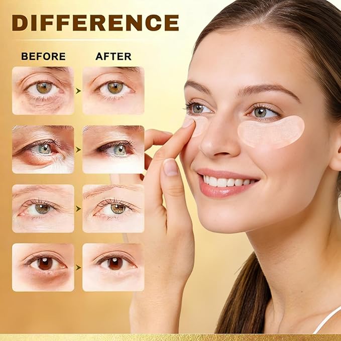 8 count PDRN Micro Eye Patches,Dark Circle,Under Eye Patches for Puffy Eyes,Ceramides, Serum-Infused Eye Patches with Hyaluronic Acid & Collagen,Gentle Skin-Friendly