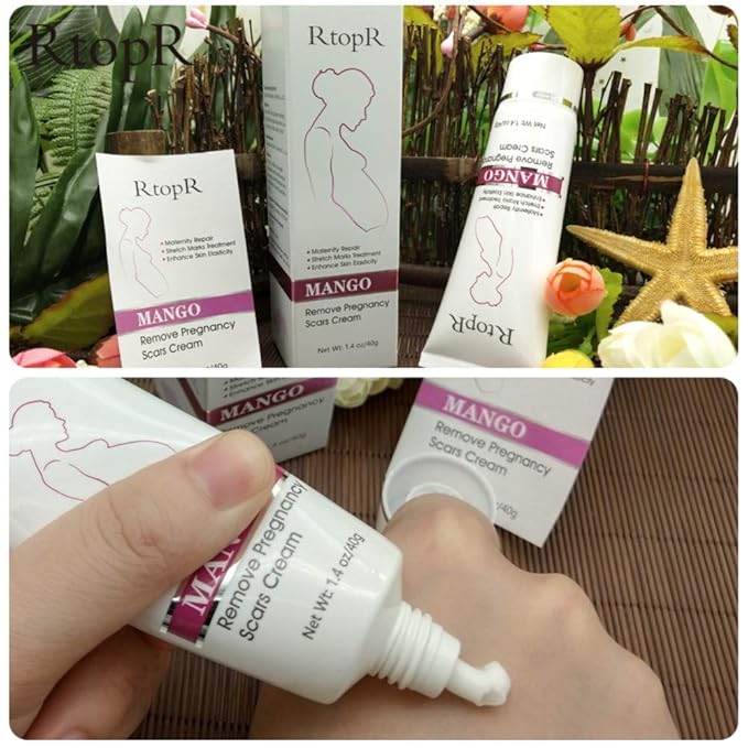 Ofanyia Stretch Mark Removal Cream Repair Scars Stretch Marks Remove Pregnancy Scar Cream