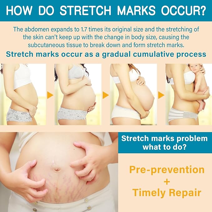 Stretch Mark Cream for Pregnancy & Postpartum,with Argan Oil, Shea Butter & Vitamin E,Stretch Mark Prevention for Belly,Moisturize Skin,Prevent & Fade stretch marks (100ml_1PACK)