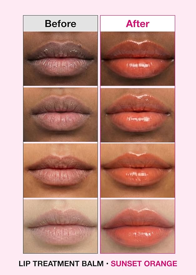 ISOI Bulgarian Rose Lip Treatment Balm (Sunset Orange) – Hydrating & Tinted Lip Balm for Dry Lips, Korean Skincare (0.18 oz, 5g)