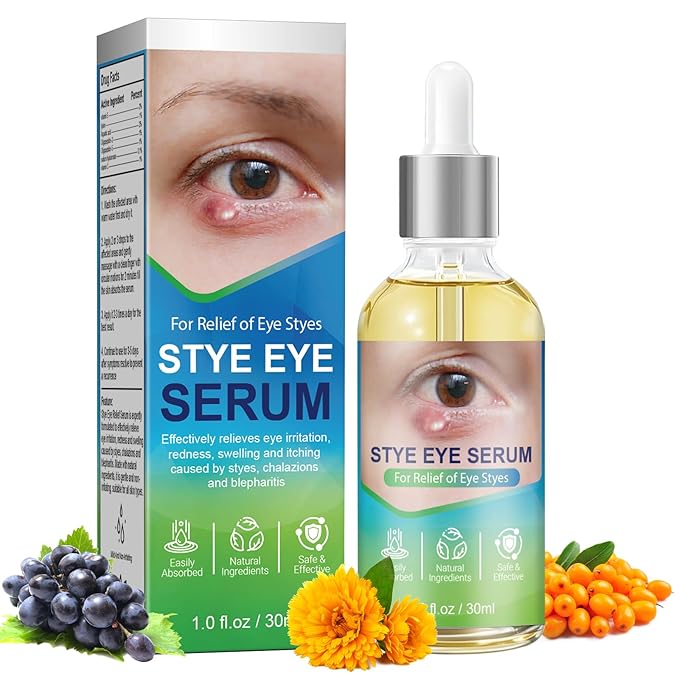 Stye Eye Relief Serum Natural Eyelid Drops for Styes Blepharitis & Chalazion Fast-Acting Relieve Eye Irritation Redness & Swelling Gentle Formula 1.01 Fl oz/30 Ml