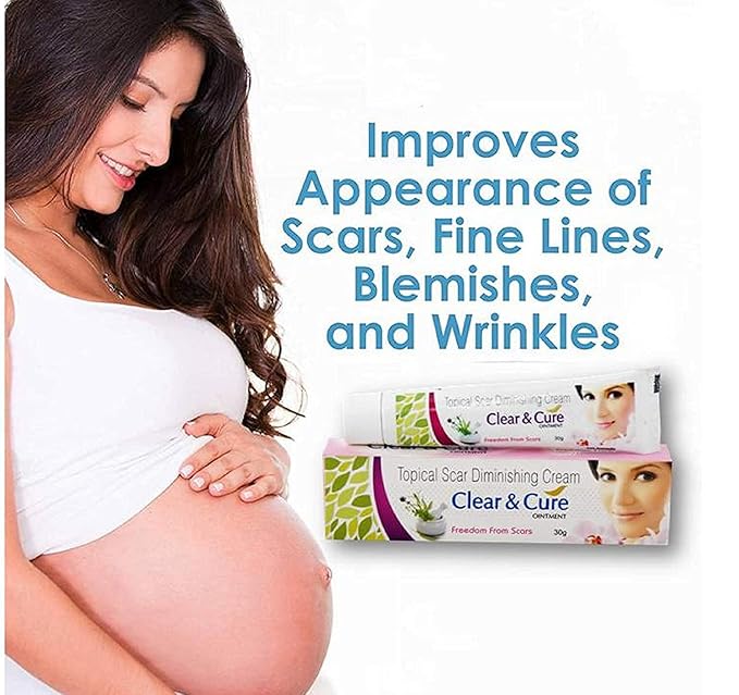 AZAZ Afflatus Ayurvedic Clear & Cure Anti Acne & Scar Removal Cream || Anti Pigmentation, Anti Blemish || Effective on Burn, Stretch & Post Pregnancy Marks- 30gm (Pack of 3)