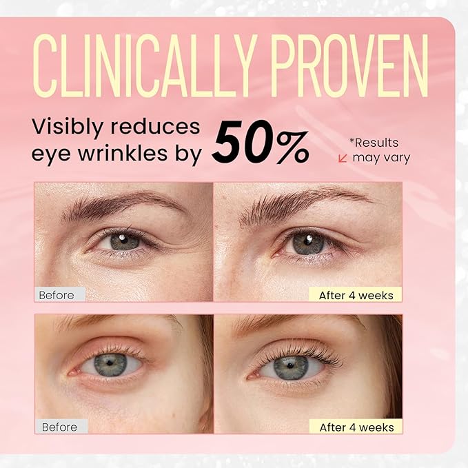 Retinol Eye Cream for Dark Circles: Revive Eye Serum for Anti-Aging - Reduces Fine Lines and Puffy Eyes for Women Day and Night Use 0.7 fl. oz