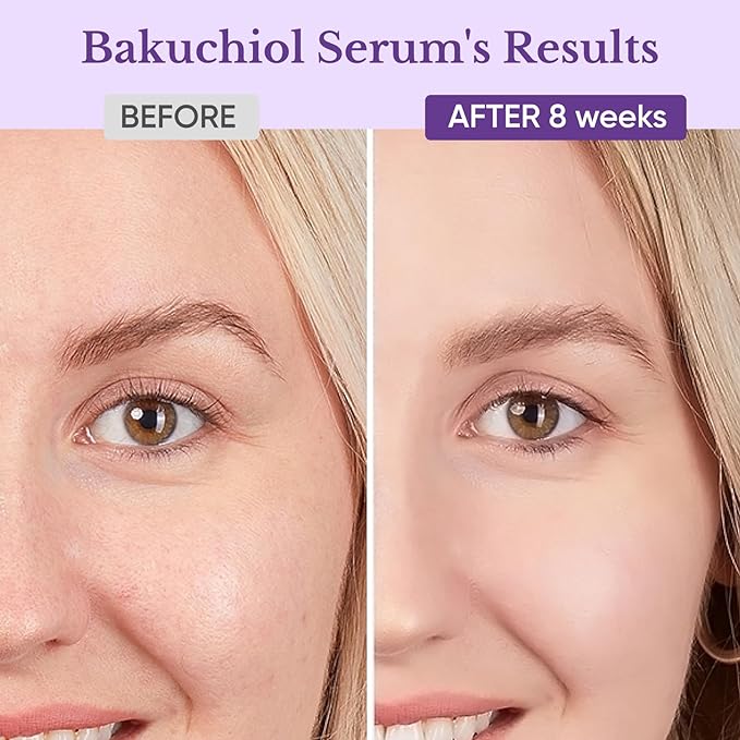 Bakuchiol Retinol Serum for Face - Retinol Alternative for Sensitive Skin with Vitamin E, Hyaluronic Acid, Collagen, Serum for Anti-Aging, Wrinkle Reduction Skin Firming & Smoothing 1 oz