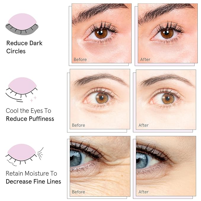 grace & stella Under Eye Mask Variety Pack - 18 Pairs of Under Eye Patches for Dark Circles - With 6 Colors (3 Pairs/Color) - Valentines Gift Bags - Gel Masks Puffy Eyes for Women, Vegan Cruelty Free