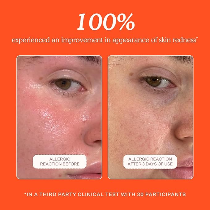 Tower 28 SOS Daily Rescue Facial Spray - Hypochlorous Acid Spray to Help Reduce Redness, Calm Irritation + Alleviate Flare-Ups - Purifying Travel Size Face Toner - Everyday Skin Care Essential (1 oz)