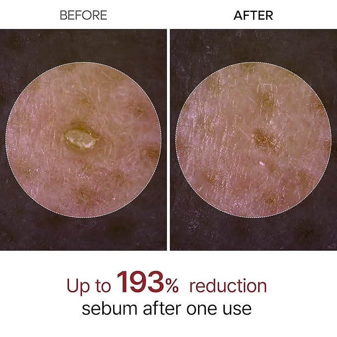 Dr.Melaxin Peel Shot Glow White Rice Peeling Ampoule 80ml, Dead Skin Gentle Exfoliating Ampoule with Rice Water Extract, AHA BHA, Niacinamide, Daily Skin Texture Care, All Skin Types, Korean Skincare