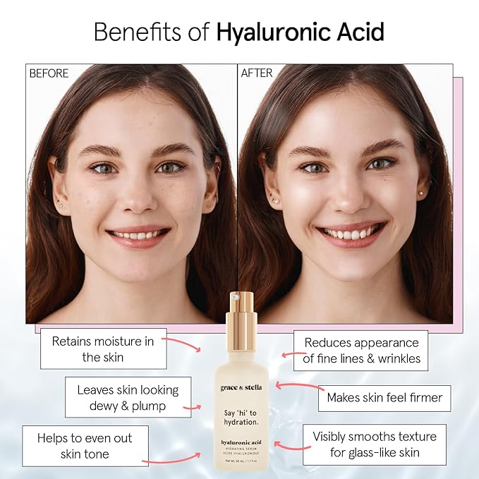 grace & stella Award Winning Hyaluronic Acid Face Serum (50ml/1.7 fl oz) Removes Fine Lines & Wrinkles, Hydrating Hyaluronic Acid Serum for Face, Acido Hialuronico for Women - Vegan Skincare (2-Pack)