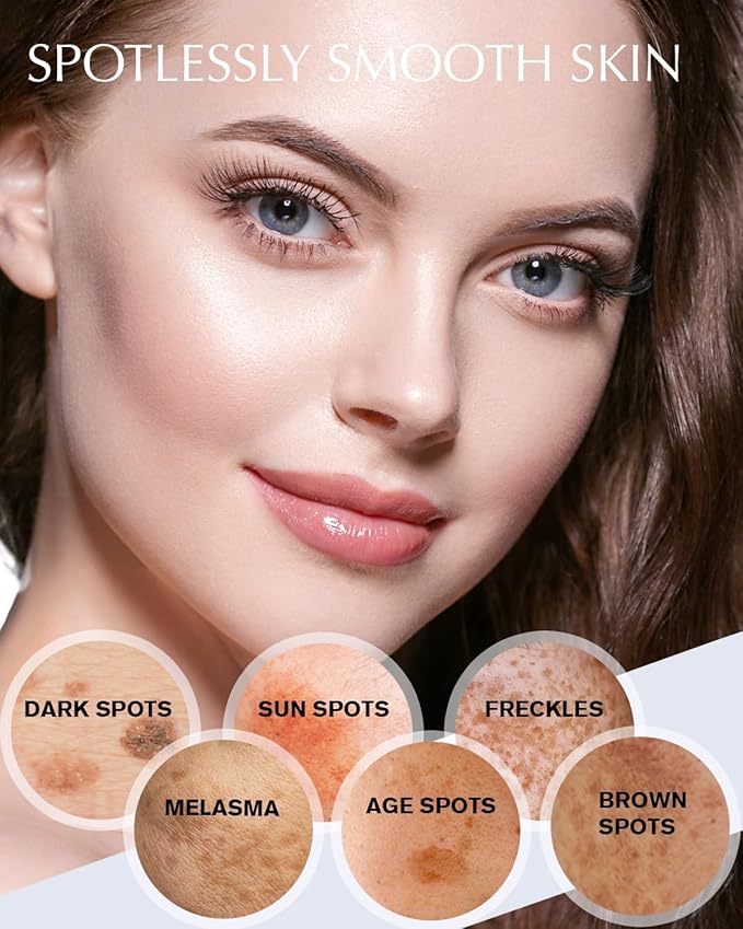 Enaskin Dark Spot Remover Cream: 2 Pack Value - Hyperpigmentation Corrector Targeting Dark Spots, Sun Spots, Freckles, Melasma & Age Spots - Dark Spot Corrector Serum for Women & Men