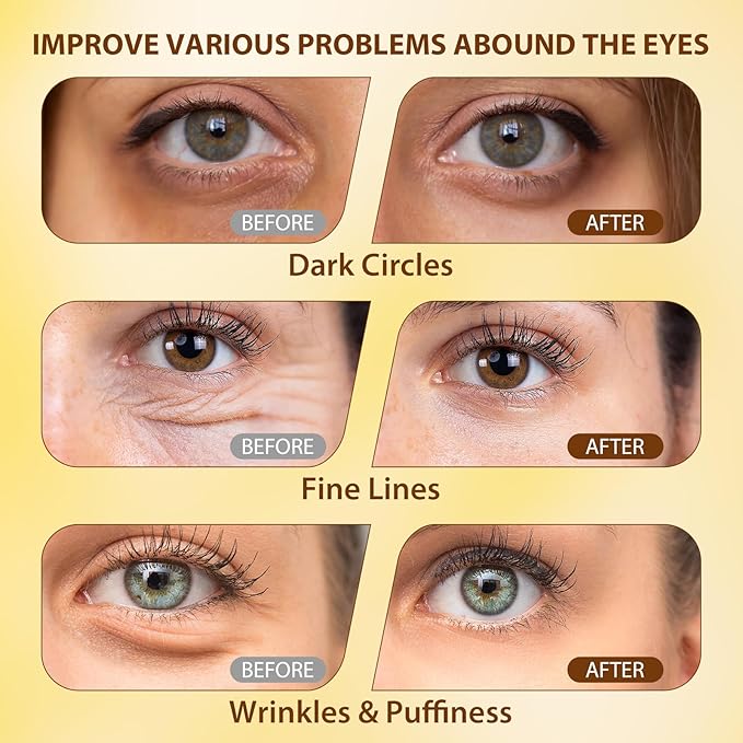 Eye Serum with 5% Caffeine, Retinol, Niacinamide & Hyaluronic Acid - Anti-Aging Treatment Eye Balms for Dark Circles, Puffiness, Wrinkles & Bags - Under Eye Brightening & Firming Cream