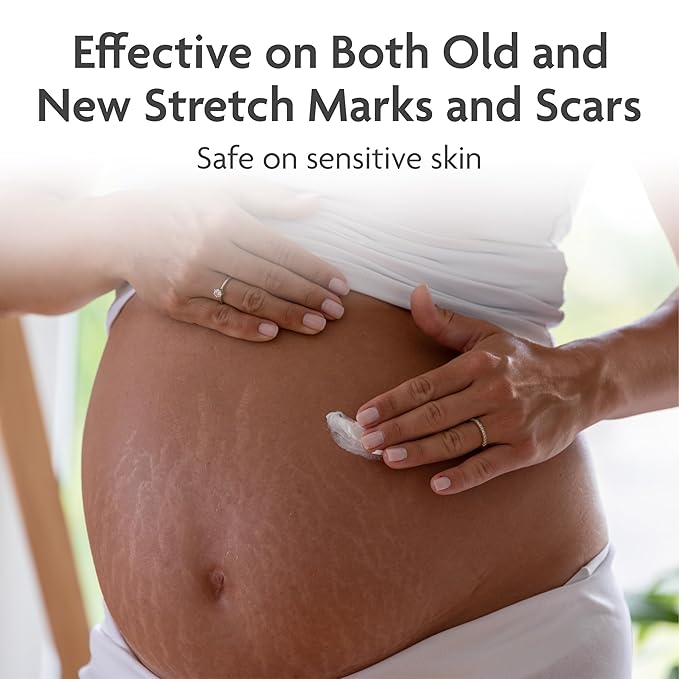 TriLASTIN Stretch Mark Cream - Collagen-Boosting Formula & Pregnancy Hospital Bag Essential - Paraben-Free Maternity Bump Butter - Fast-Absorbing Unscented Stretch Mark Lotion - 5.5 Oz Tube
