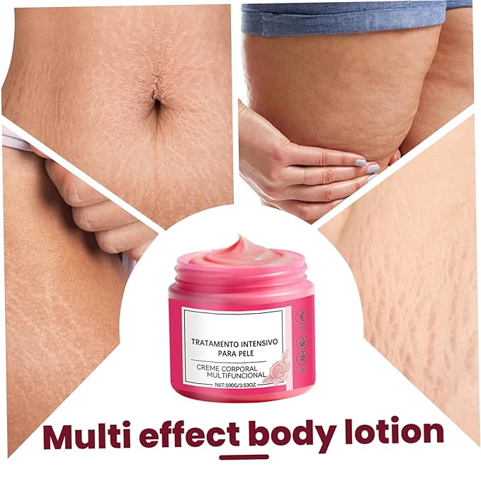 Pregnancy Stretch Mark Cream - Belly Butter for Pregnancy Improve Skin's Appearance 100g Rose Scented Moisturizer for Daily Skin Care, 3Pcs