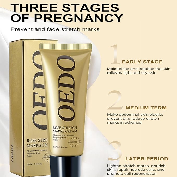 Rose Remove Stretch Marks Cream for Pregnancy Scar Removal Cream Natural Plant Essence Formula Prevention Remove Stretch Mark Old Scars Body Moisturizer 40g