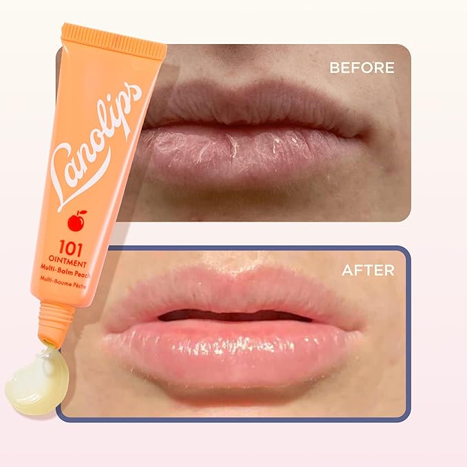 Lanolips 101 Ointment - Lanolin Lip Balm for Smooth, Hydrated & Healthy Lips - Multipurpose Ointment with Lanolin Oil for Dry Cuticles & More - Peach (0.52 oz)