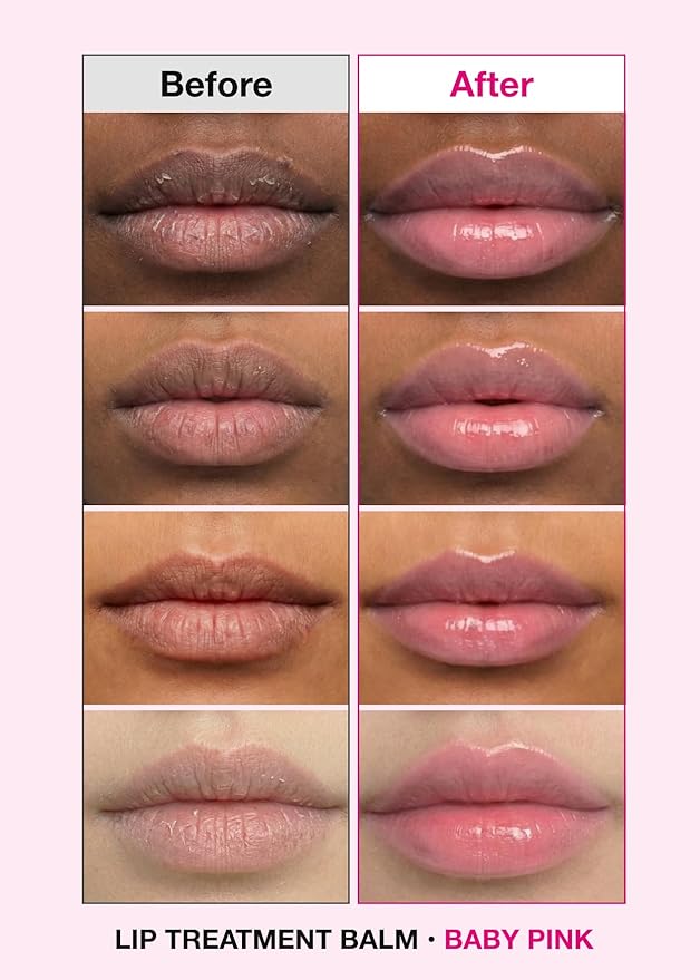 ISOI Bulgarian Rose Lip Treatment Balm (Baby Pink) – Hydrating & Tinted Lip Balm for Dry Lips, Korean Skincare (0.18 oz, 5g)