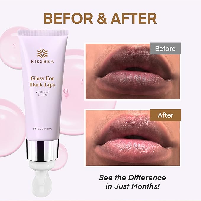 Gloss for Uneven Lip Tone – Refreshing Vanilla Scent – 2 Pack (15 mL Each)