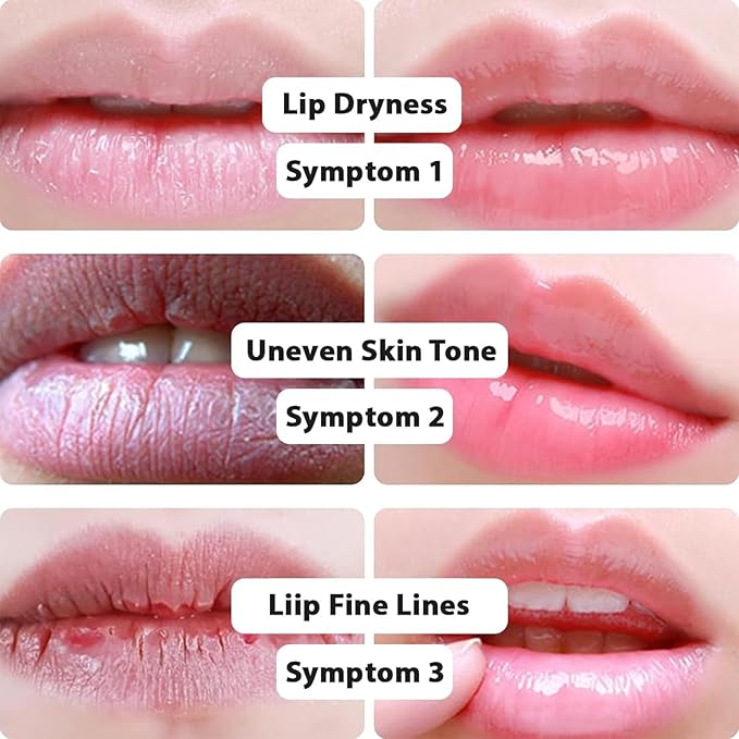 30 Pairs Pink Lip Masks & 24K Gold Eye Masks, Effectively Moisturizing the Skin, Moisturizing Cooling Skin Lines Dark Circles,Wrinkles Fine Lines, Hangover Kit