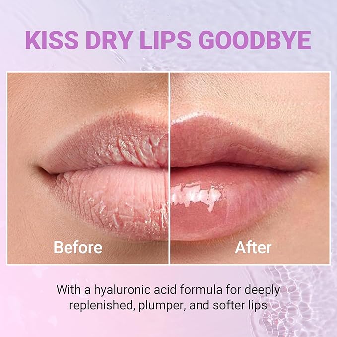 iMethod Lip Mask Overnight - Lip Sleeping Mask for Dry Lips, 8-Hour Hydrating Lip Balm with Hyaluronic Acid, Intense Moisturizing Lip Treatment to Nourish & Repair - Honey