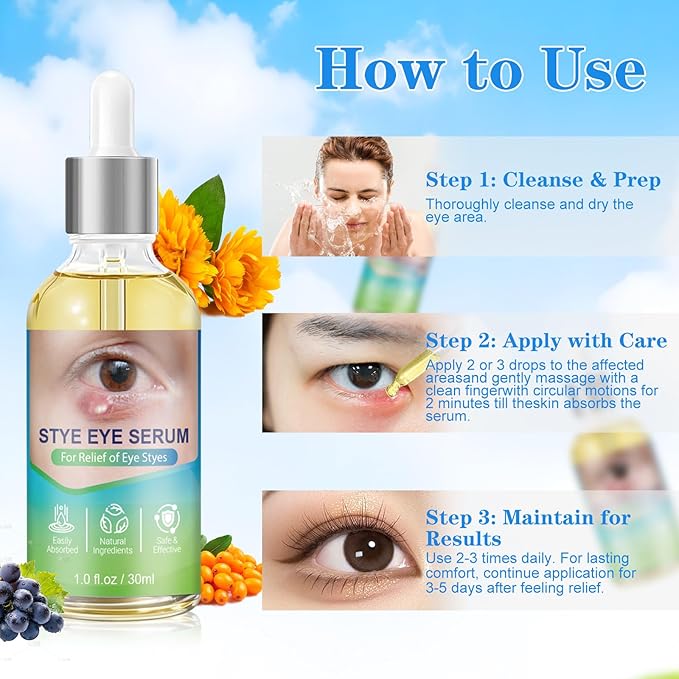 Stye Eye Relief Serum Natural Eyelid Drops for Styes Blepharitis & Chalazion Fast-Acting Relieve Eye Irritation Redness & Swelling Gentle Formula 1.01 Fl oz/30 Ml