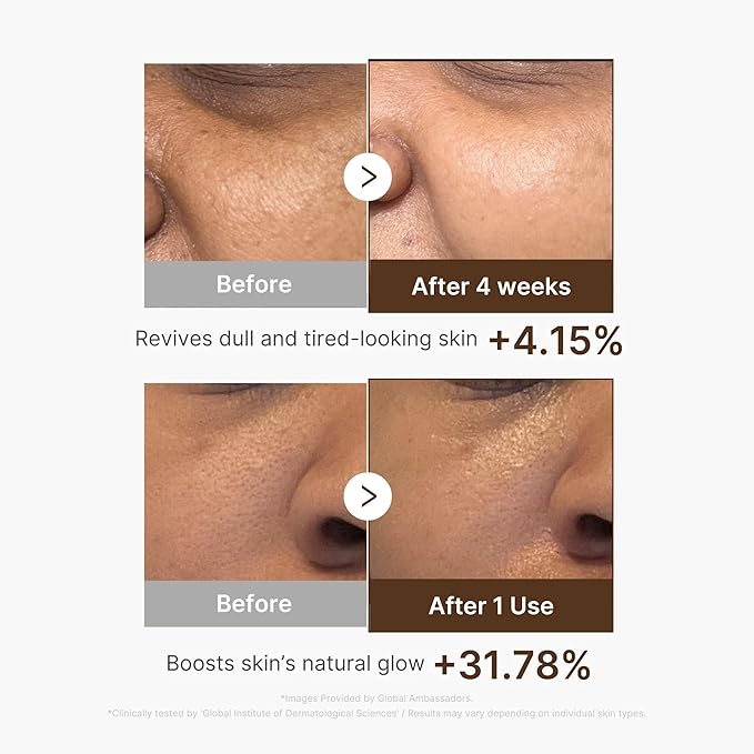 medicube Deep Vitamin C Capsule Serum | Hydrating Vitamin C Serum for Dull & Uneven-Looking Skin with Visible Concerns | Liposome Capsules for Smooth, Radiant Texture | Korean Skincare 1.01 fl.oz