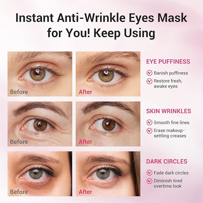 Serene Eyes Patches with PDRN & Collagen, Upgraded Instant Anti-Wrinkle Eye Mask for Dark Circles & Puffy Eyes, Hyaluronic Acid Hydrating Under Eye Patches, Instalift Treatment, 10 Pairs