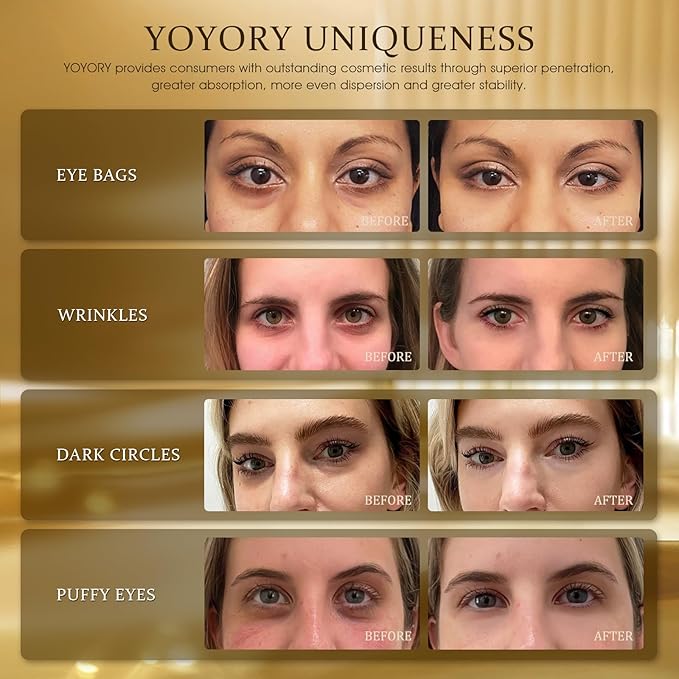 Under Eye Patches Masks - for Dark Circles, Puffy Eyes, Fine Lines, Wrinkles, Eye Bags Treatment with Collagen and Hyaluronic Acid,Anti-Aging, Moisturizing and Hydrating 24K Gold (60 Pcs)