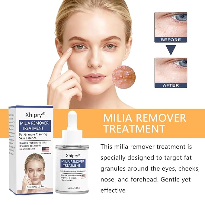 Milia Remover for Face, Milia Bump Remover Under Eye, Spot Treatment Serum with Salicylic Acid, Milia Acne Cream 30Ml