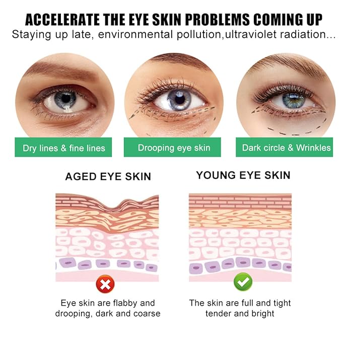SORYA Caffeine Eye Cream for Dark Circles & Puffiness Anti-Aging– Day & Night Under Eye Cream with Niacinamide & Peptides (1.7 oz)