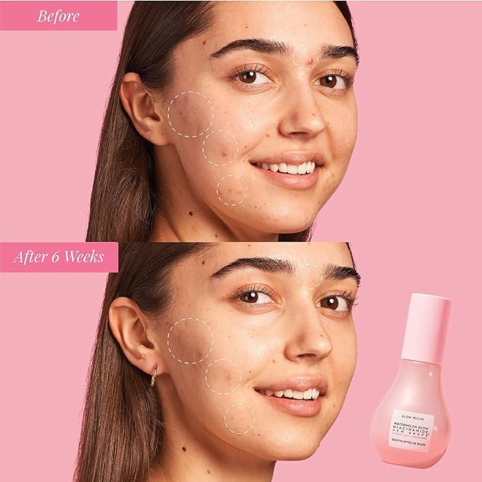 Glow Recipe Watermelon Niacinamide Dew Drops, Travel Size, Korean Niacinamide Serum Drops, Hydrating Face Serum + Primer & Liquid Highlighter, Hyaluronic Acid, Dewy Glow (15ml)