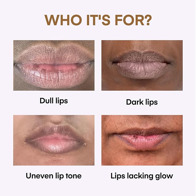 Lip Lightening for Dark Lips: for Smokers, Dry or Uneven-Toned Lips – Restores Natural Look & Moisture with VC, Lemon Peel & Licorice – Refreshing Vanilla Scent – 15 mL