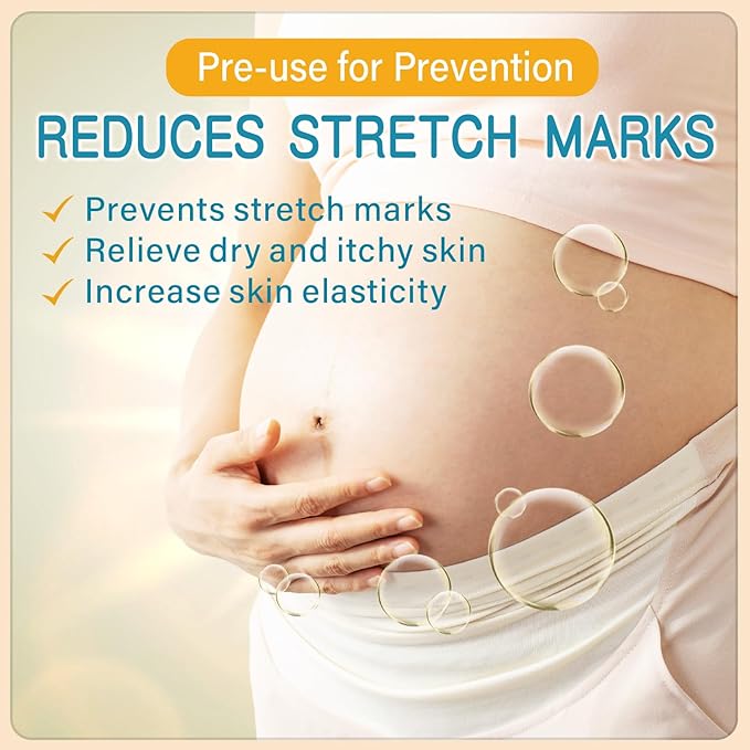 PEGO Stretch Mark Butter for Pregnancy,Women Belly Butter,Shea Butter,Maternity Stretch Mark Cream,Massages Body & Reduces Scar Appearance, Postpartum Care for Moms,Hypoallergenic100g/3.53oz