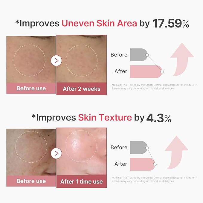 medicube Exosome Shot PDRN Pink Collagen 2,000 PPM Spicule Facial Serum | Liquid Skin Booster | Exosome, Salmon DNA Spicules | Uneven Skin Tone, Pore Care, Skin Texture | Korean Skincare, 1.01 fl.oz