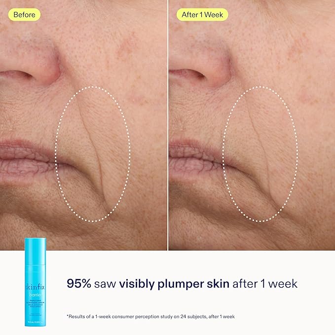 Skinfix Barrier+ Better Skin Starts Here Kit - Includes Mini Triple Lipid-Peptide Cream (0.5 oz), Mini Foaming Oil Cleanser (2 oz) & Mini Triple Lipid Activating Serum (0.35 oz) - Vegan, Cruelty Free