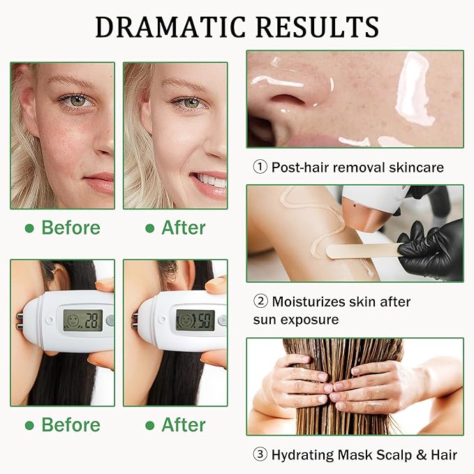 Aloe Vera Gel for Sunburn Relief,Hydrating Travel Size Aloe Vera Gel for Face,Moisturizing Sunburn Relief After Sun Lotion,Fast Absorbing,Non-Sticky Cooling After Sun Lotion Face Moisturizer (A)