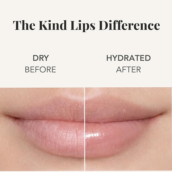 Kind Lips Vanilla Lemon Organic Lip Balm Natural Moisturizing Lip Care 3 Pack