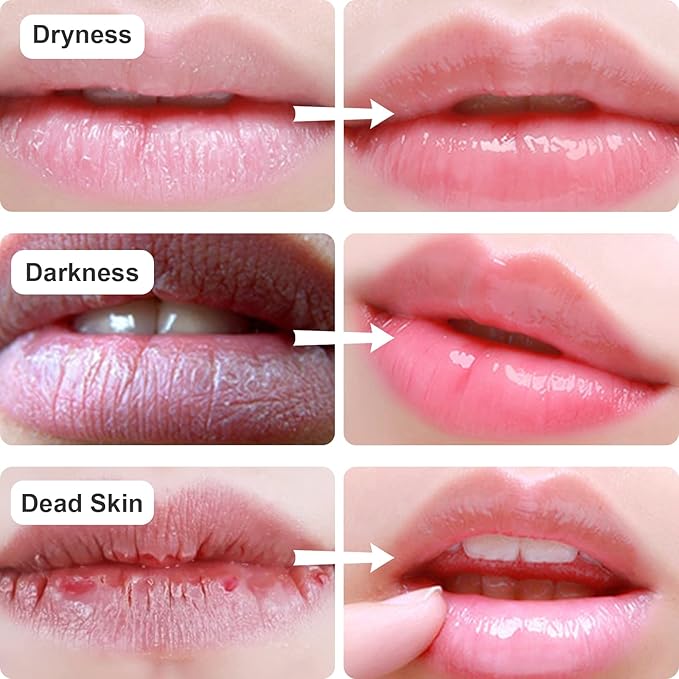 Permotary 30 PCS Collagen Lip Mask Crystal Mouth Care Gel Pads for Moisturizing & Reducing Chapped, Smoothing Fine Lines-Lip Patches for Firms & Hydrate