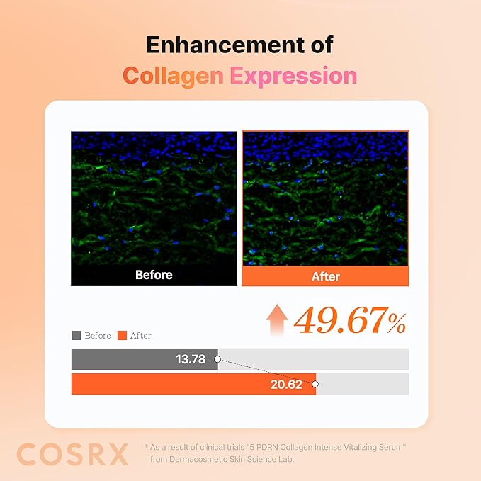COSRX 5 PDRN Collagen Intense Vitalizing Serum - Korean Serum for Skin Firming & Glowing with Salmon DNA, Centella, Lactobacillus PDRN & Collagen, Korean Skin Care (3.38 fl.oz.)