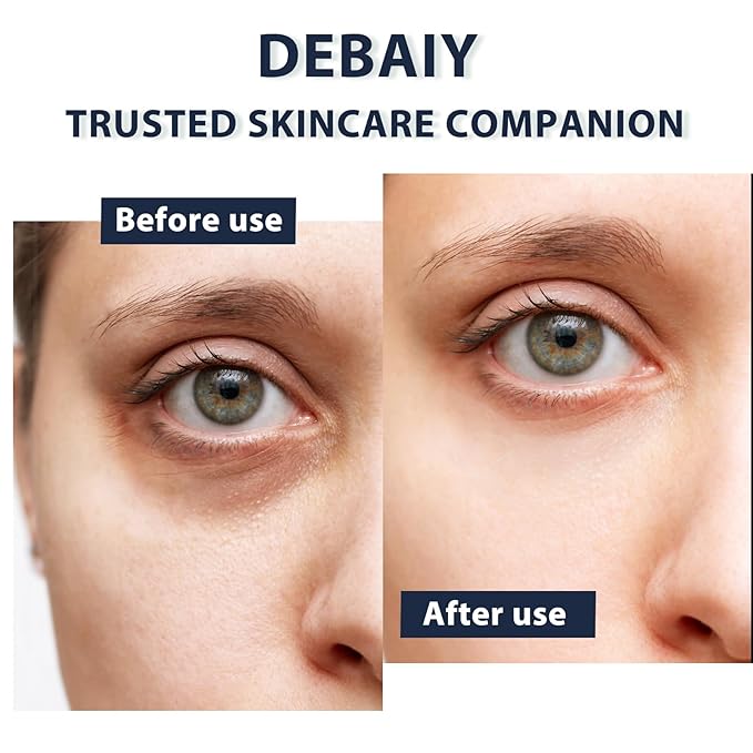 3% Caffeine Eye Cream for Dark Circles Puffiness & Bags Under Eyes Night Cream (3 Pack 15g Each)