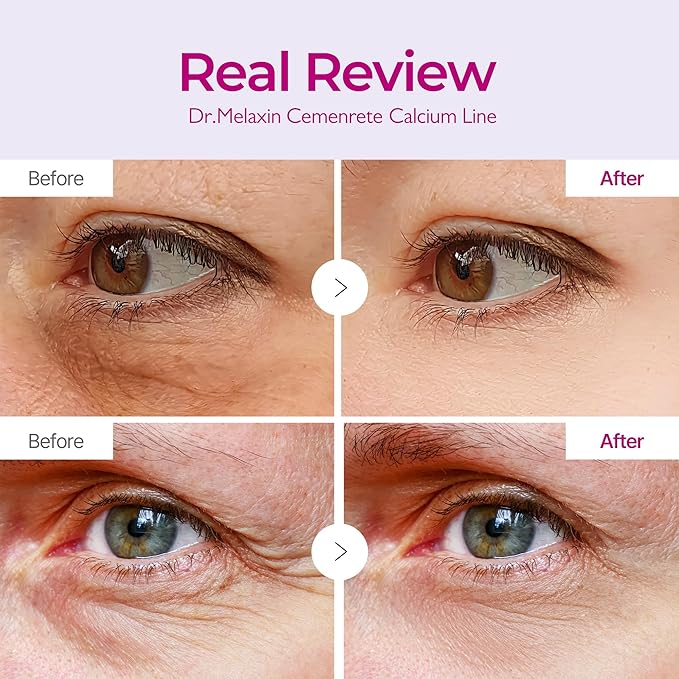 Dr.Melaxin Calcium Volume Eye Patches – Firming Hydrogel Under Eye Masks for Puffiness & Fine Lines, Deep Hydration, 60 Count