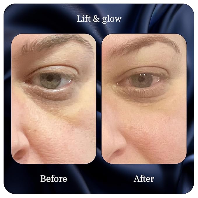 Lift & Glow Organic Eye Cream for Dark Circles and Puffiness - Anti Aging Eye Cream for Wrinkles - Reduces Dark Circles and Under Eye Bags - With Kakadu Plum, Coconut Oil, Spirulina & More - 1 Fl Oz