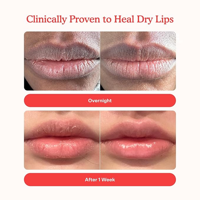 Tower 28 LipSoftie Tinted Lip Balm Treatment - Hydrating Glossy Balm + Overnight Lip Mask with Jojoba Oil + Shea Butter - Sweet, Cushiony Formula for Smooth, Soft Lips - SOS Vanilla (0.38 oz)