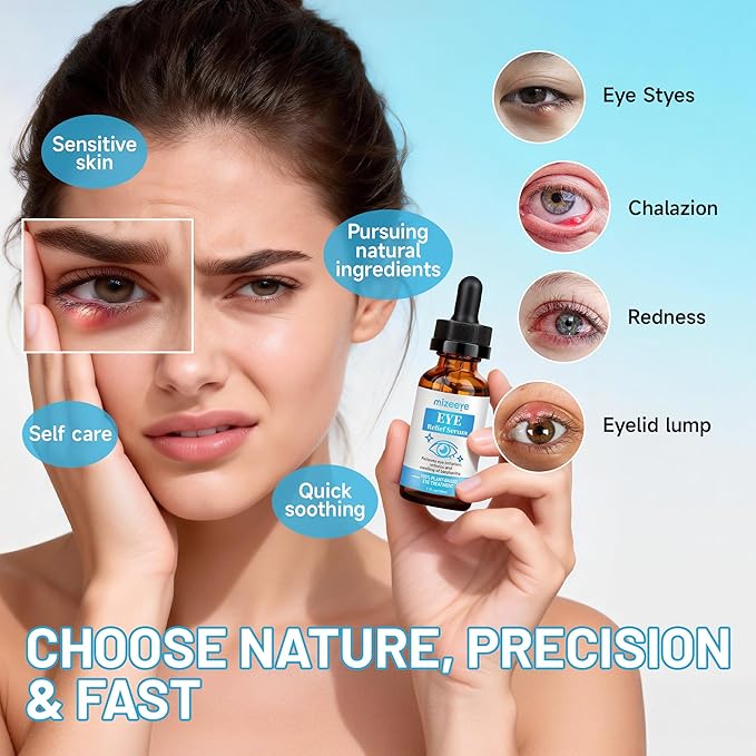 Eye Serum For Chalazion & Blepharitis, 30ML Chalazion Remover For Eyelid, Blepharitis Eyelid Serum With Avocado Oil, Sea Buckthorn Oil & Caffeine, Relieve Puffiness and Eye Fatigue