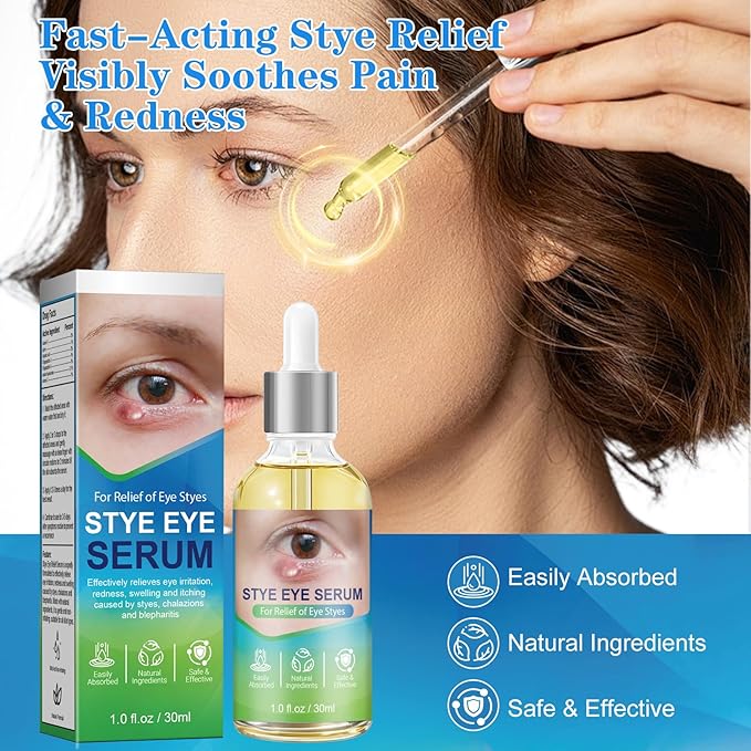 Stye Eye Relief Serum Natural Eyelid Drops for Styes Blepharitis & Chalazion Fast-Acting Relieve Eye Irritation Redness & Swelling Gentle Formula 1.01 Fl oz/30 Ml