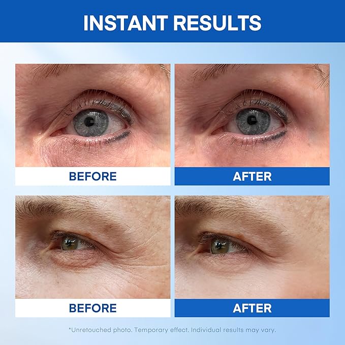 Instant Under Eye Lift Serum: Reduces Eye Bags, Wrinkles, Puffy Eyes, Dark Circles & Crow’s Feet in Minutes - Advanced Firming Polysaccharide Formula for Mature Skin - 20 Resealable Tubes