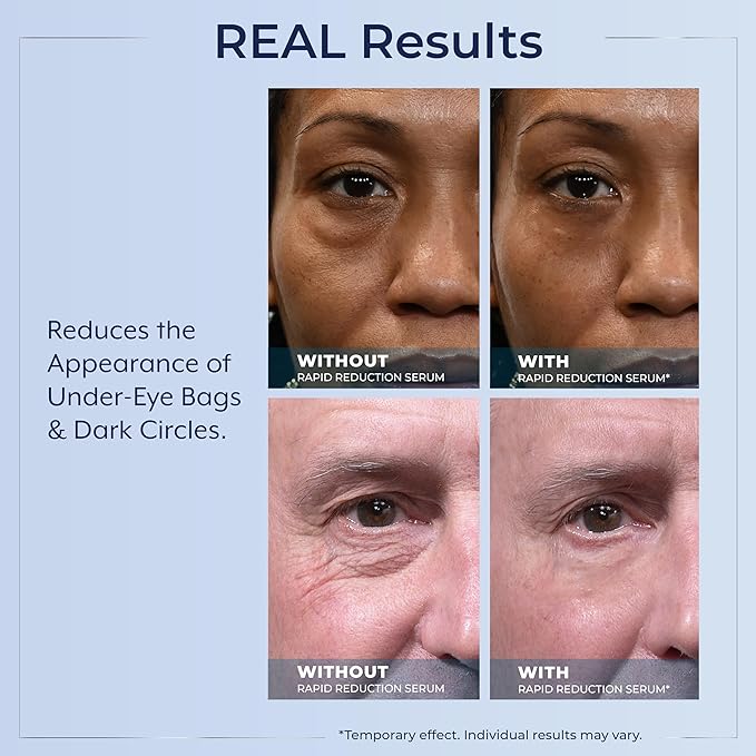 Plexaderm Rapid Reduction Eye Serum - Visibly Reduces Under-Eye Bags, Wrinkles, Dark Circles, Fine Lines & Crow's Feet Instantly, Anti Aging Wrinkle Remover for Face, Full Size Tube