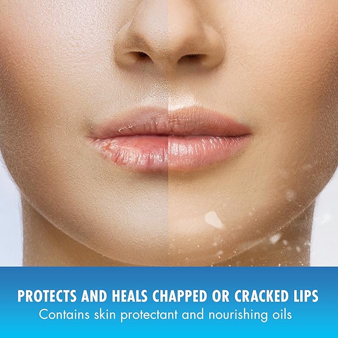 Natural Ice Original Medicated Lip Balm, Hydrating Lip Care for Dry, Chapped Lips, Moisturizing Formula with SPF 15 Helps Prevent Sunburn, Protection for Smooth, Soft Lips (Pack of 48)