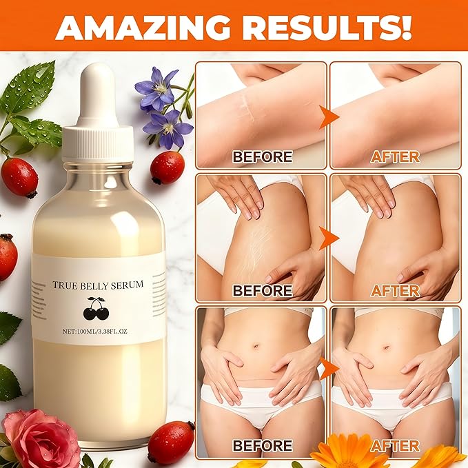 True Belly Serum - Organic Firming & Cellulite Appearance & Hydrating Belly Oil for Stretch Mark, Belly Oil For Pregnant Women, Promotes Skin Nourishment & Suppleness, 100ml (1PCS)