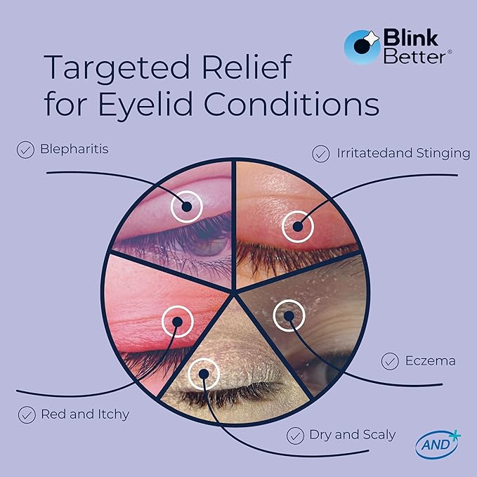 BetterLids Eyelid Ointment for Dry, Itchy & Sensitive Eyelids – Deep-Moisturising Oat Complex with Shea Butter & Panthenol to Hydrate, Nourish & Soothe Delicate Eyelid Skin – 0.34 oz